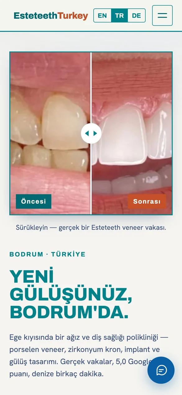 Esteteeth mobil görünümü